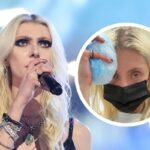 Taylor Momsen Hospitalized, Shows Photo of Spider Rash