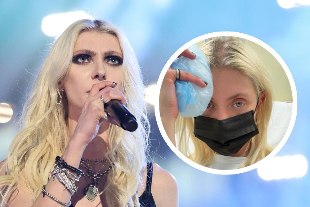 Taylor Momsen Hospitalized, Shows Photo of Spider Rash